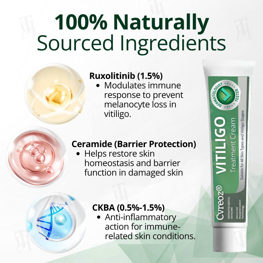 đ„Hot Sales - 60% OFFđ„CvreozÂź Vitiligo Treatment Cream