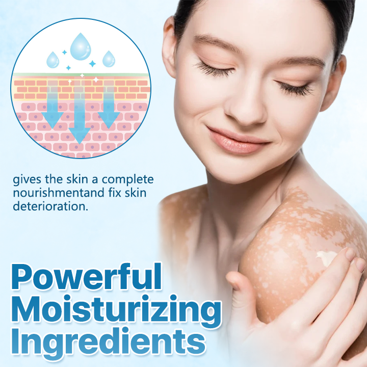 🔥LAST DEAL: 60% OFF🔥Cvreoz® Vitiligo ReBalance Soothing Ointment