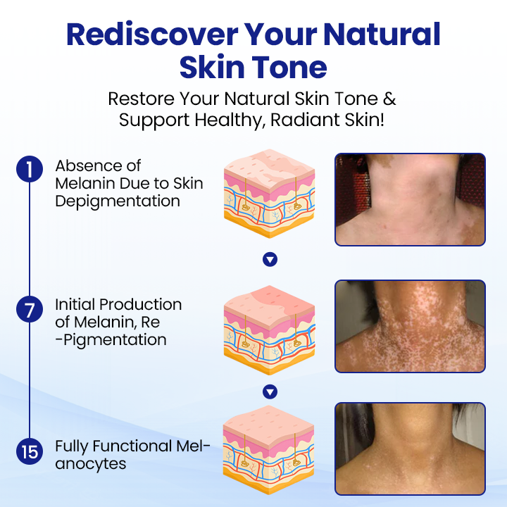 ⏰Last Day Promotion: 60% OFF🔥 Cvreoz® Herbal VitiCare Spray