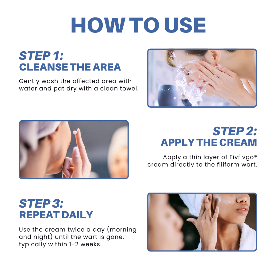 Cvreoz® HPV Facial Filiform Warts Removal Cream