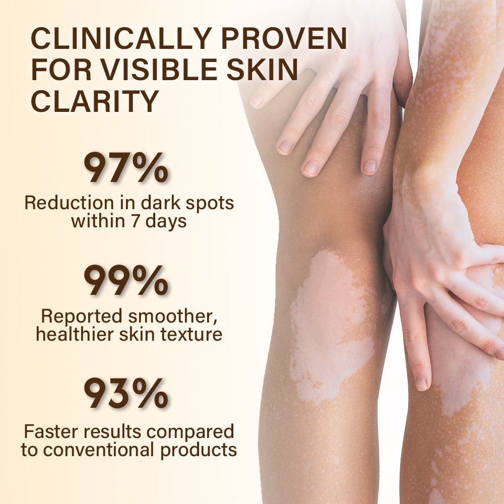 ⏰Limited Stock🔥Flash Sale 60% OFF🔥 Cvreoz® VitiClear Bee Venom Cream