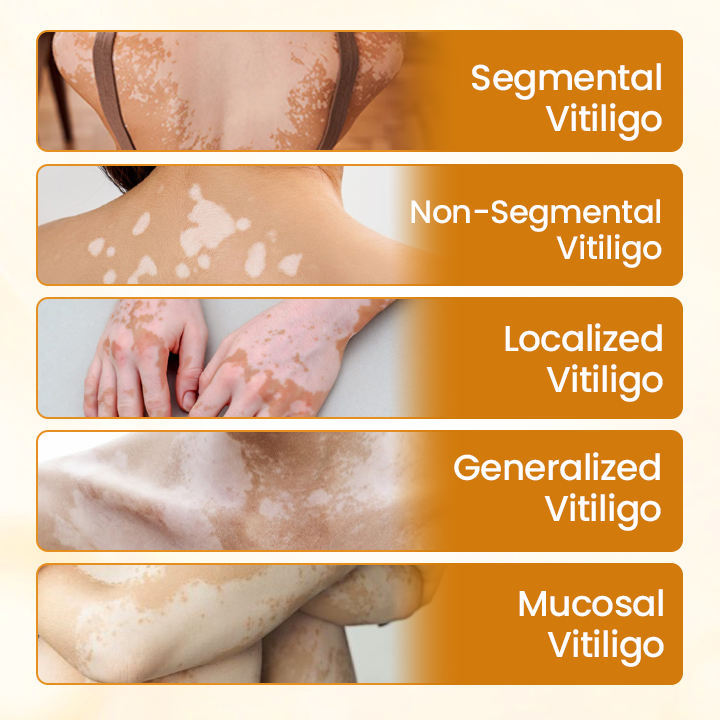 ⏰Last Day Promotion: 60% OFF🔥Cvreoz® VitiliGo Bee Toxin Cream