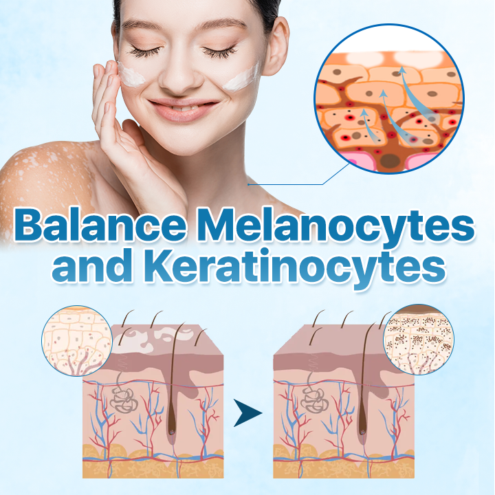 🔥LAST DEAL: 60% OFF🔥Cvreoz® Vitiligo ReBalance Soothing Ointment