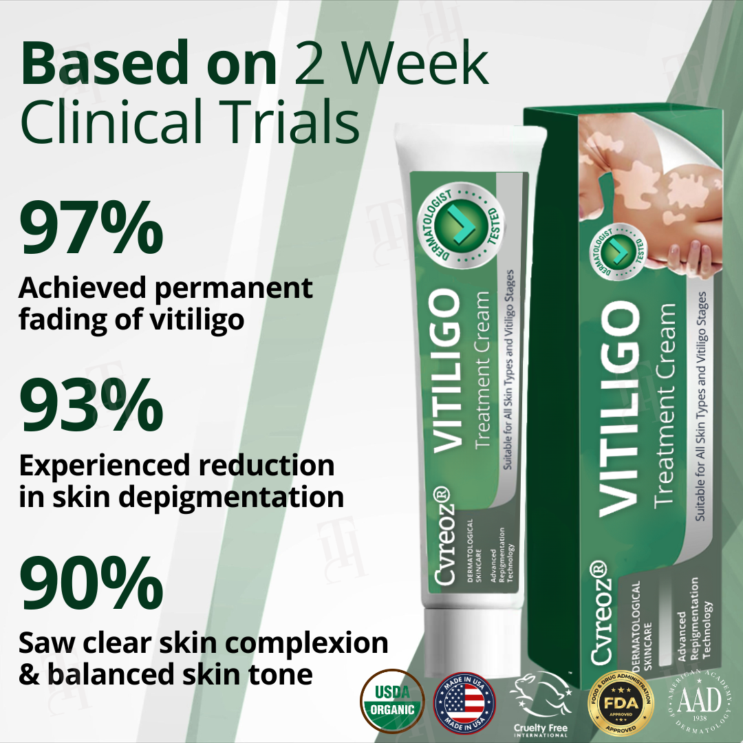 đ„Hot Sales - 60% OFFđ„CvreozÂź Vitiligo Treatment Cream