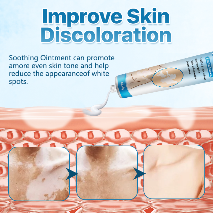 🔥LAST DEAL: 60% OFF🔥Cvreoz® Vitiligo ReBalance Soothing Ointment