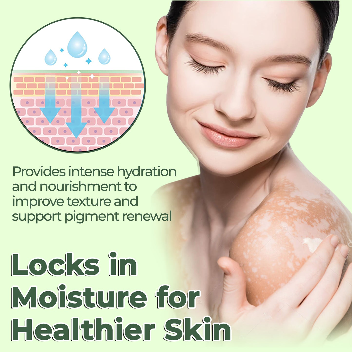 🔥LAST DEAL: 60% OFF🔥 Cvreoz® Vitiligo Treatment Ointment