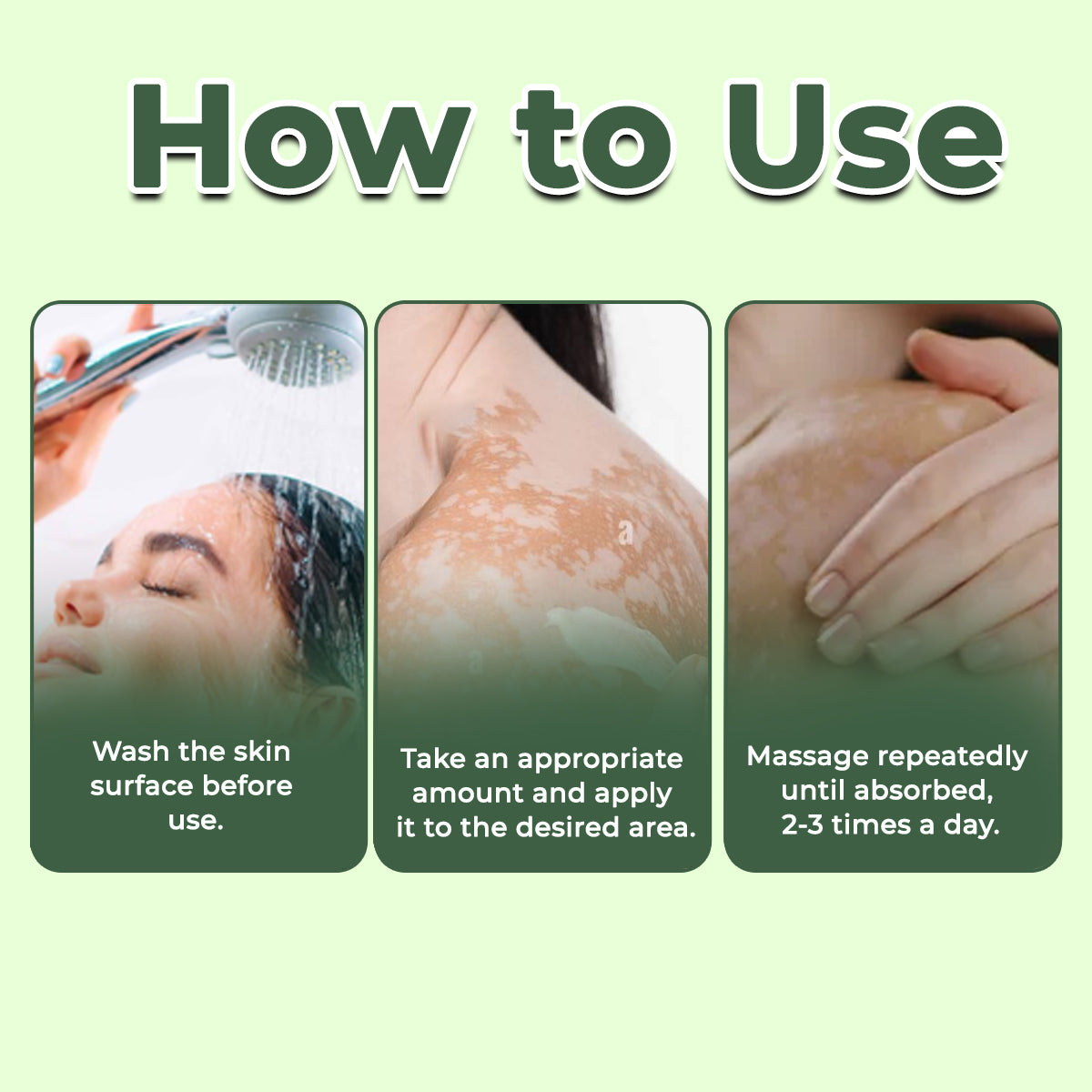 🔥LAST DEAL: 60% OFF🔥 Cvreoz® Vitiligo Treatment Ointment