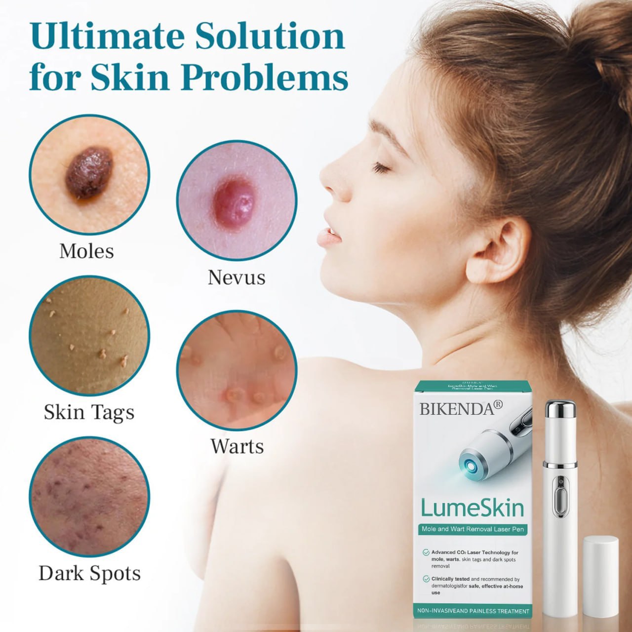 💫 Bikenda® Advanced LumeSkin Mole and Wart Removal Laser Pen 🔦 🔥 UP TO 60% OFF 🔥