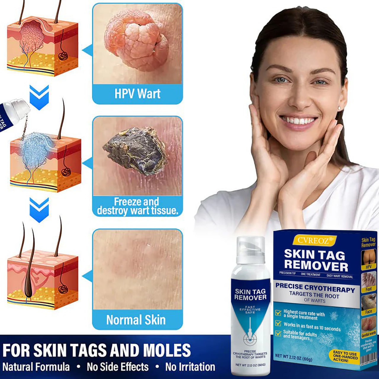 🔥Last Deal: 60% Off🔥 CVREOZ® TagRecede Cryo Treatment Spray