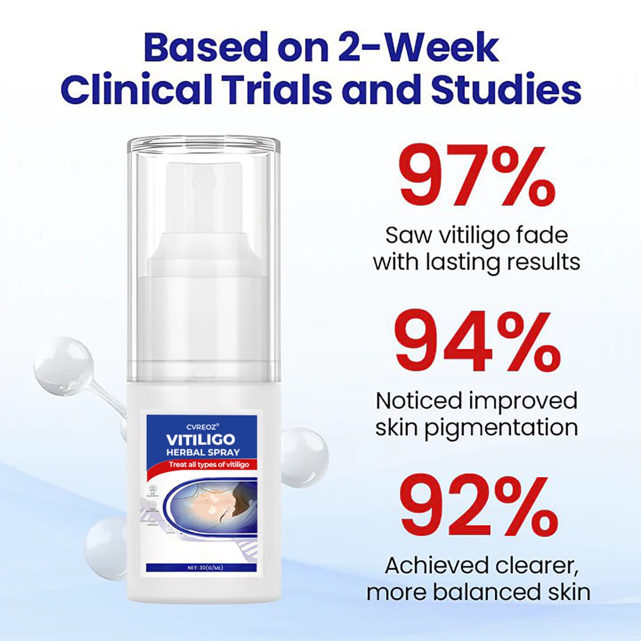 đ CVREOZÂŽ Vitiligo Herbal Spray â¤ď¸ SUMMER SALE 60% OFFâ¤ď¸âđĽ