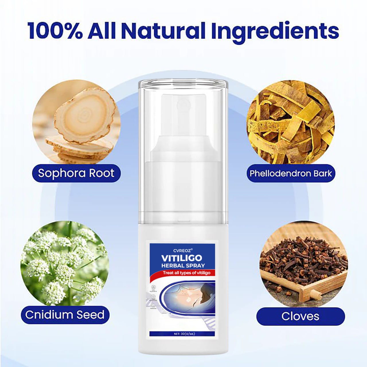đ CVREOZÂŽ Vitiligo Herbal Spray â¤ď¸ SUMMER SALE 60% OFFâ¤ď¸âđĽ