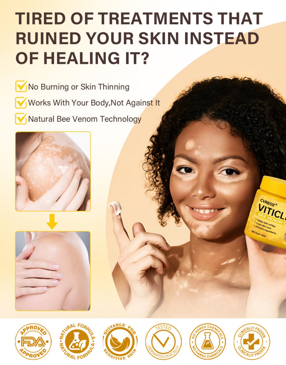 ⏰Limited Stock🔥Flash Sale 60% OFF🔥 Cvreoz® VitiClear Bee Venom Cream