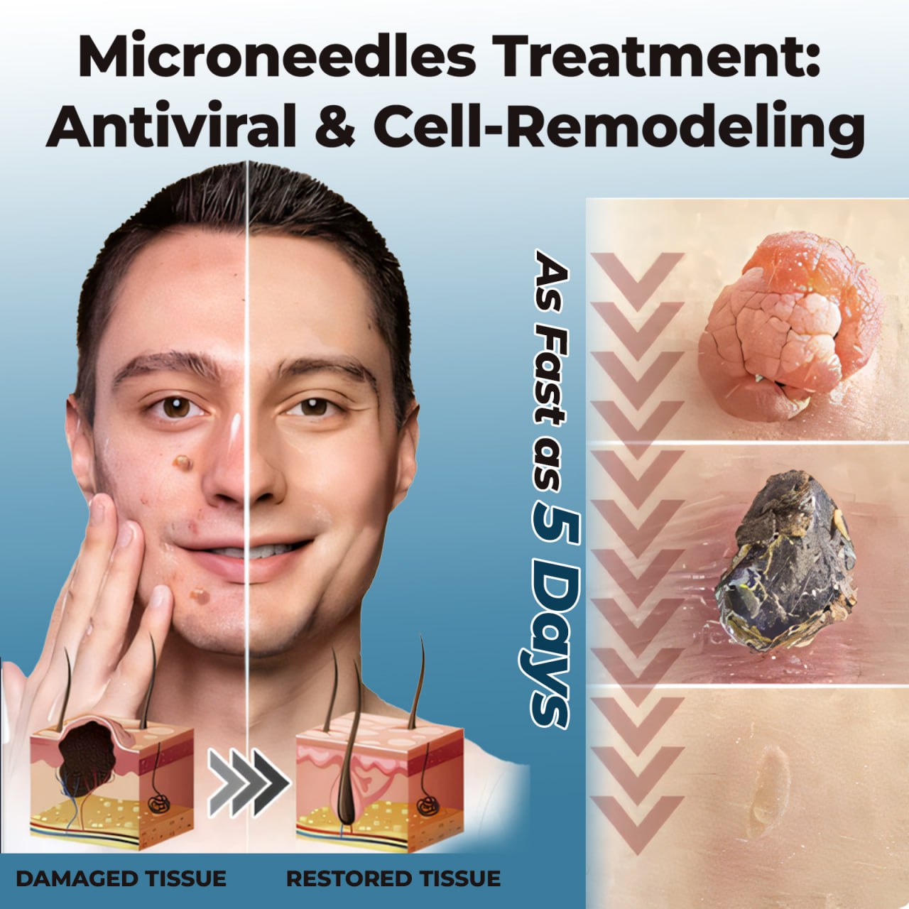 CVREOZ® Skin Tag Patches Mole & Wart Remover