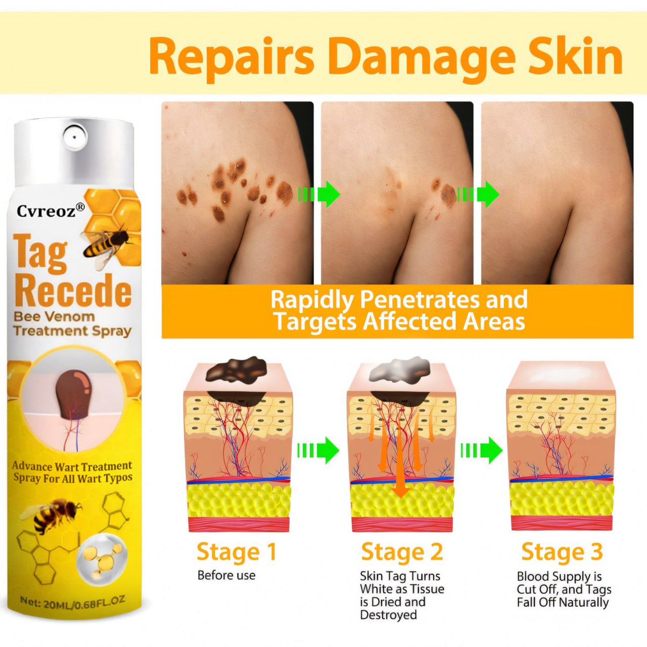⭐Cvreoz® TagRecede Bee Venom Treatment Spray 🐝 LIMITED OFFER 60% OFF 💛