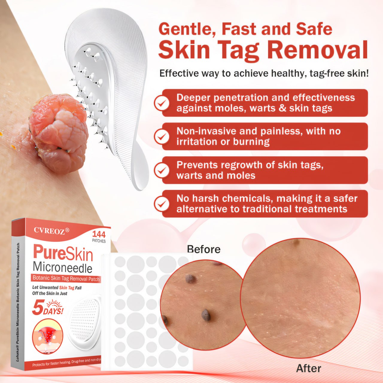 🔥HOT SALE: 60% OFF🔥Cvreoz® PureSkin Microneedle Botanic Patch