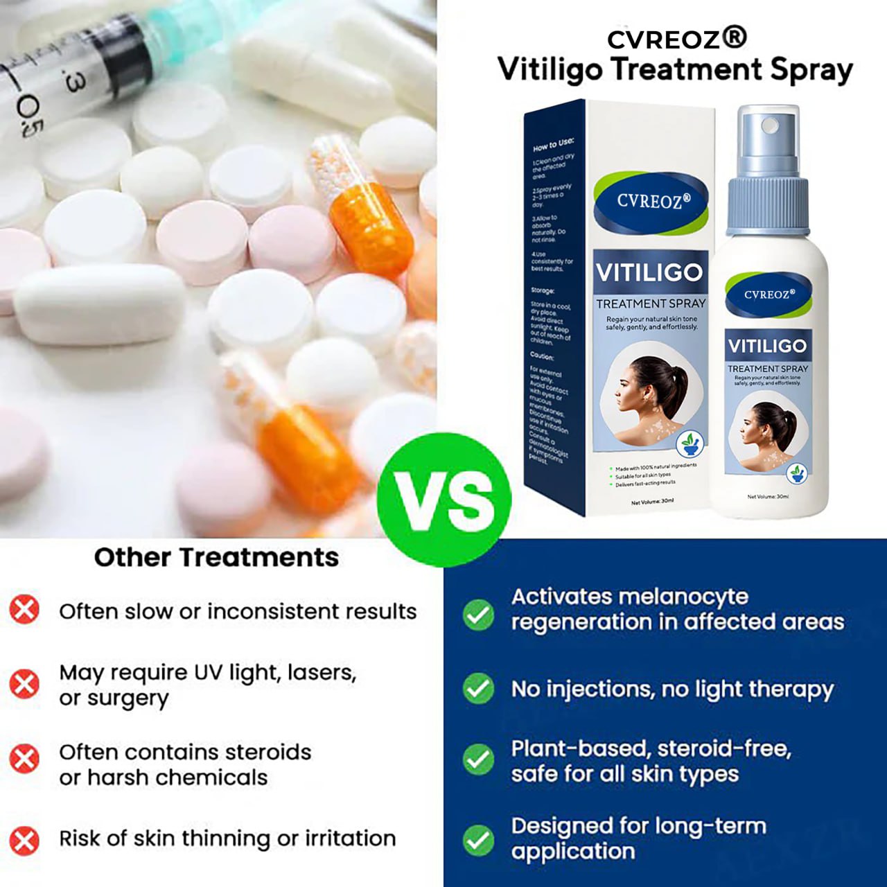 ⏰Limited Stock🔥Flash Sale 60% OFF🔥 Cvreoz® Vitiligo Treatment Spray