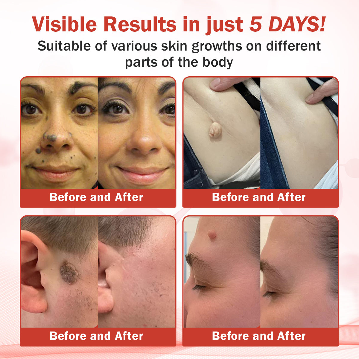🔥HOT SALE: 60% OFF🔥Cvreoz® PureSkin Microneedle Botanic Patch