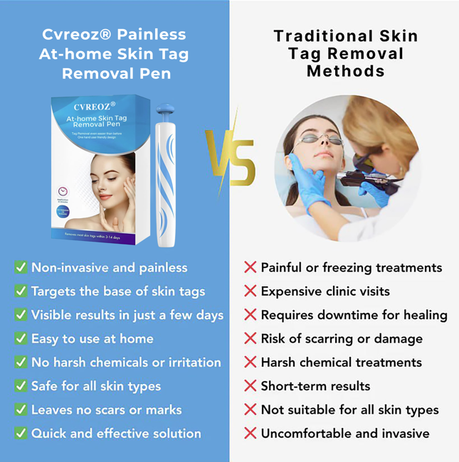 Cvreoz® Skin Tag Removal Pen