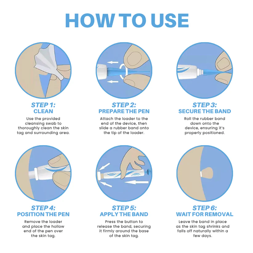 Cvreoz® Skin Tag Removal Pen