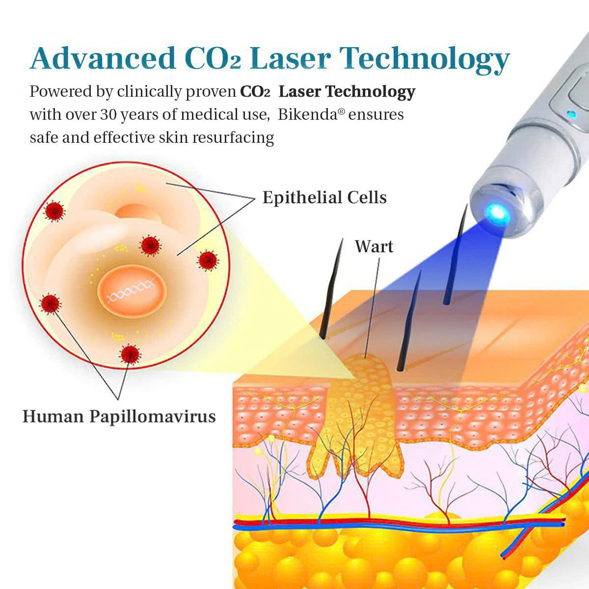 💫 Bikenda® Advanced LumeSkin Mole and Wart Removal Laser Pen 🔦 🔥 UP TO 60% OFF 🔥