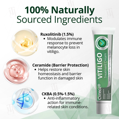 🔥Hot Sales - 60% OFF🔥Cvreoz® Vitiligo Treatment Cream