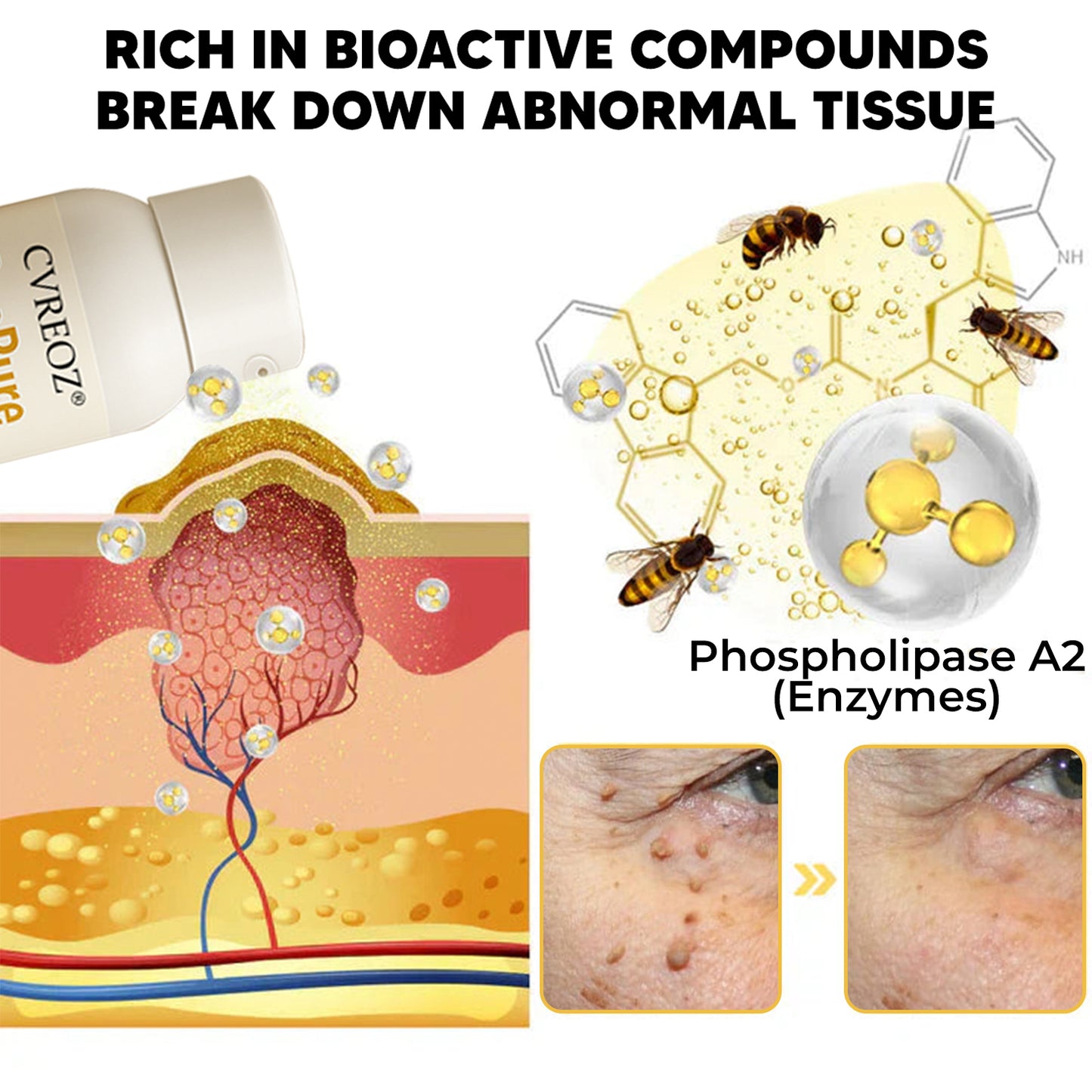 🎉SPECIAL OFFER: 60% OFF This Week Only!🔥 Cvreoz® BeePure Skin Tag Treatment Spray