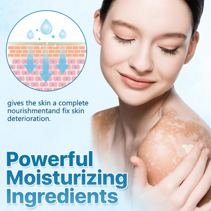 🔥LAST DEAL: 60% OFF🔥Cvreoz® Vitiligo ReBalance Soothing Ointment