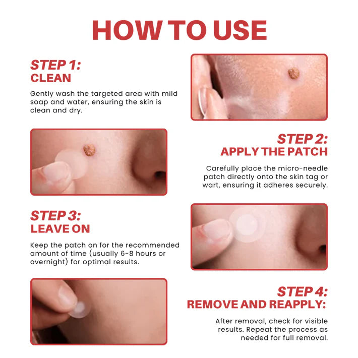 CVREOZ® DermaSmooth Skin Tag Remover Patch 🔥 Special Deal: 60% OFF ⏰