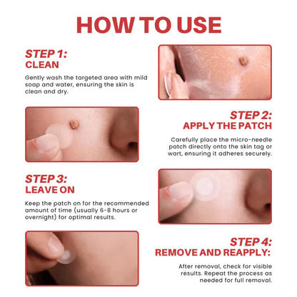 CVREOZ® DermaSmooth Skin Tag Remover Patch 🔥 Special Deal: 60% OFF ⏰