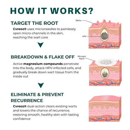 Cvreoz® Genital Wart Removal Patch – Now 60% OFF | Pain-Free, Clinically Proven Solution