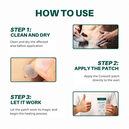 Cvreoz® Genital Wart Removal Patch – Now 60% OFF | Pain-Free, Clinically Proven Solution