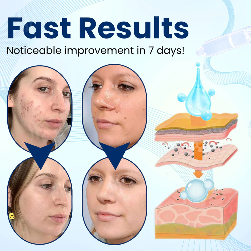 Cvreoz® Skin Tag & Mole Removal Serum