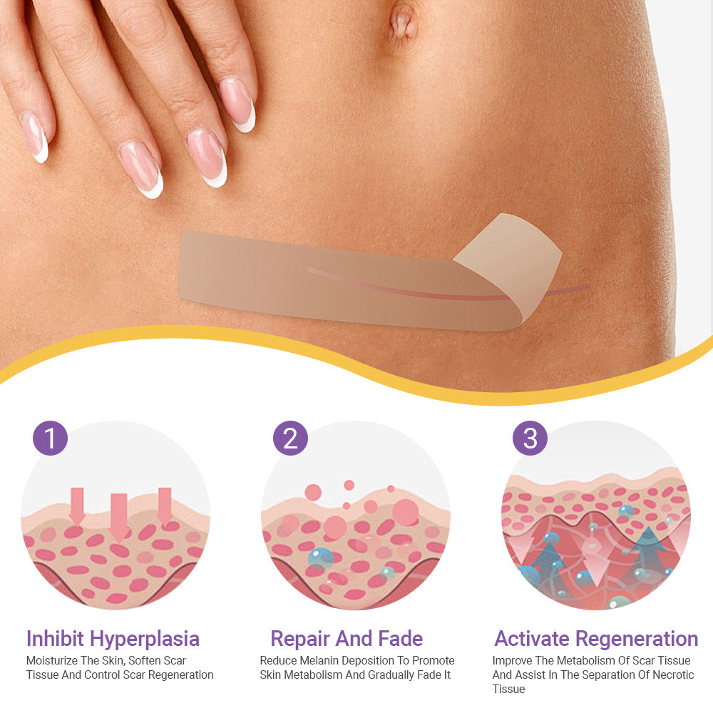 CVREOZ® Hyaluronic Acid Nano Microneedle Repair Tape⏰Limited Offer: Up to 60% OFF🔥