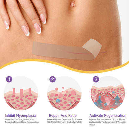CVREOZ® Hyaluronic Acid Nano Microneedle Repair Tape⏰Limited Offer: Up to 60% OFF🔥