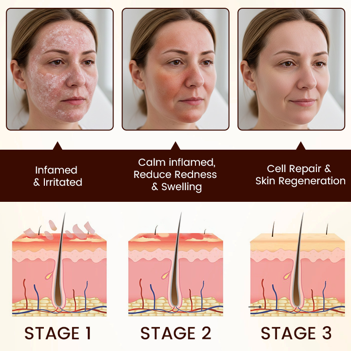 Cvreoz® Bee Venom Multi-Repair Cream