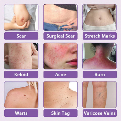 CVREOZ® Hyaluronic Acid Nano Microneedle Repair Tape⏰Limited Offer: Up to 60% OFF🔥