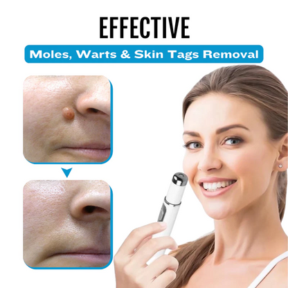 Bikenda® SpotlessDerm Mole and Wart Laser Pen