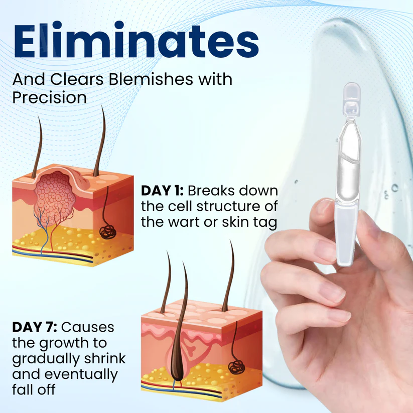 Cvreoz® Skin Tag & Mole Removal Serum