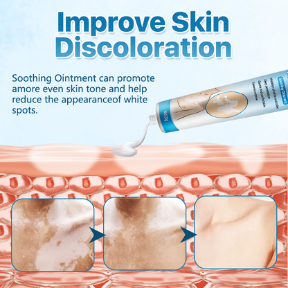 🔥LAST DEAL: 60% OFF🔥Cvreoz® Vitiligo ReBalance Soothing Ointment