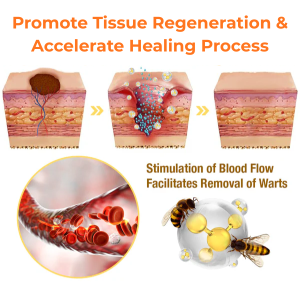 🎉SPECIAL OFFER: 60% OFF This Week Only!🔥CVREOZ® Skin Tag Bee Venom Treatment Cream