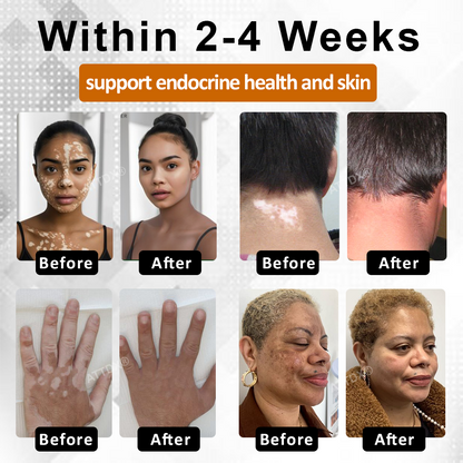 Cvreoz® MelanoCare Skin Rebalancing VitiBee Cream