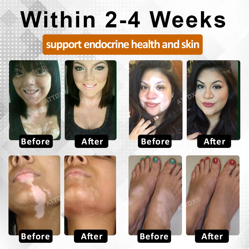 Cvreoz® MelanoCare Skin Rebalancing VitiBee Cream