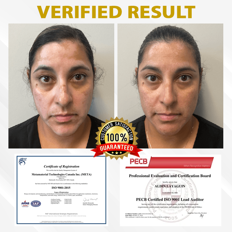 Cvreoz® MelanoCare Skin Rebalancing VitiBee Cream