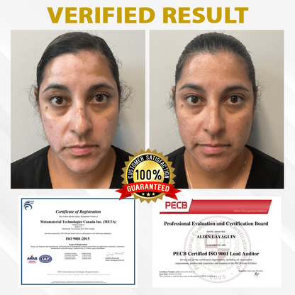 Cvreoz® MelanoCare Skin Rebalancing VitiBee Cream