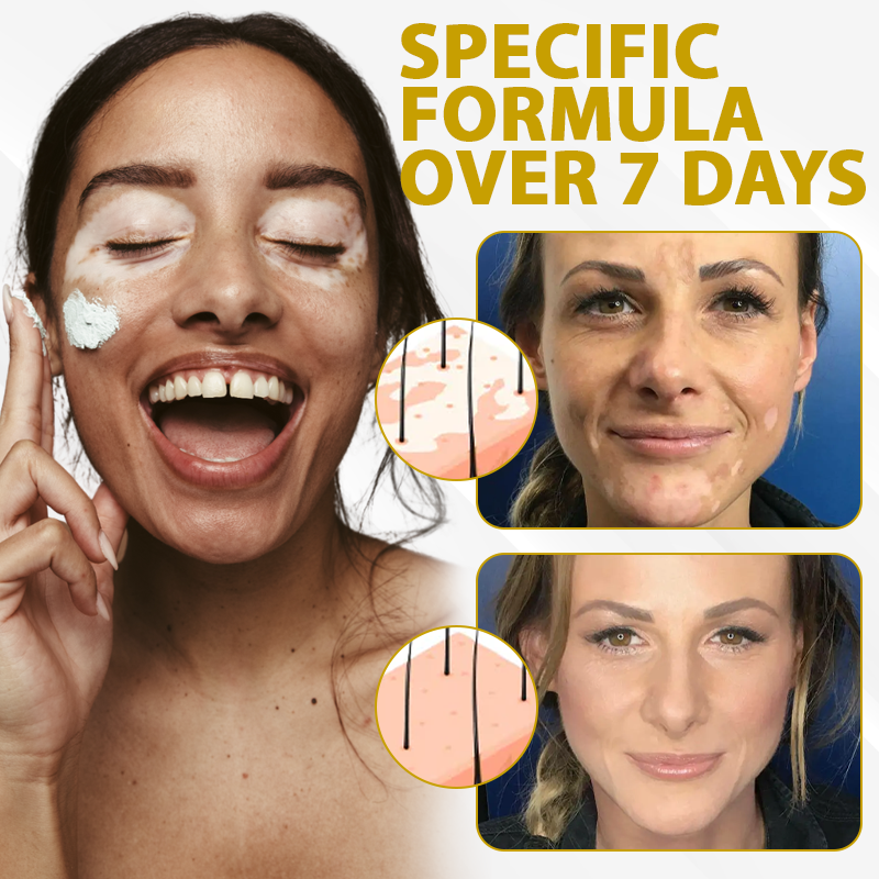 Cvreoz® MelanoCare Skin Rebalancing VitiBee Cream