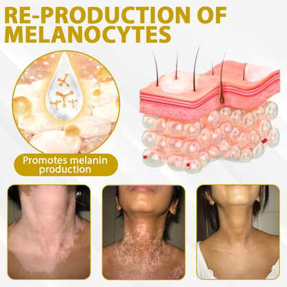 Cvreoz® MelanoCare Skin Rebalancing VitiBee Cream