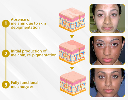 Cvreoz® MelanoCare Skin Rebalancing VitiBee Cream