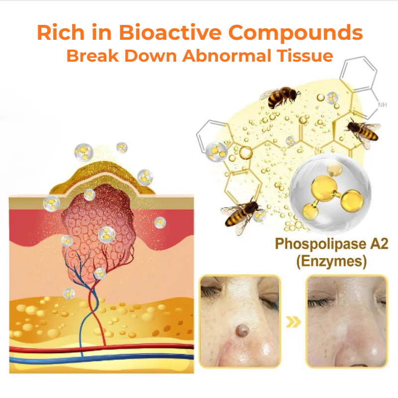 🎉SPECIAL OFFER: 60% OFF This Week Only!🔥CVREOZ® Skin Tag Bee Venom Treatment Cream