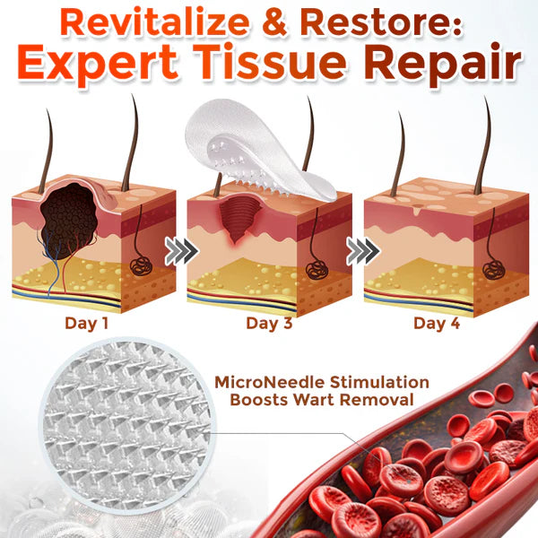 🔥 Last Day: 60% OFF ⏰ CVREOZ® Microneedle Botanic Skin Tag Removal Patch