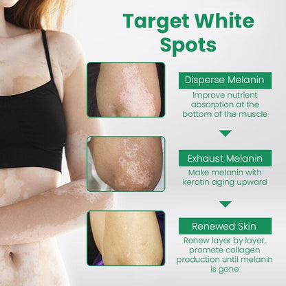 💛  LIMITED OFFER 60% OFF 💛  Cvreoz® VitiligoCare Revitalizing Elixir